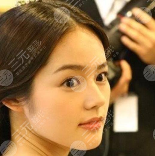 韓佳人的鼻子有多絕?