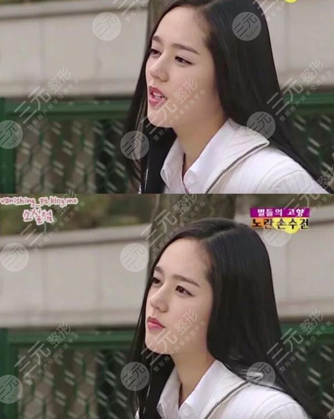 韓佳人的鼻子有多絕?