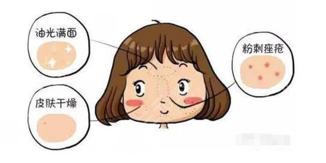 干貨分享|干皮vs油皮、油痘肌VS油敏肌，四者如何區(qū)分？怎么改良？