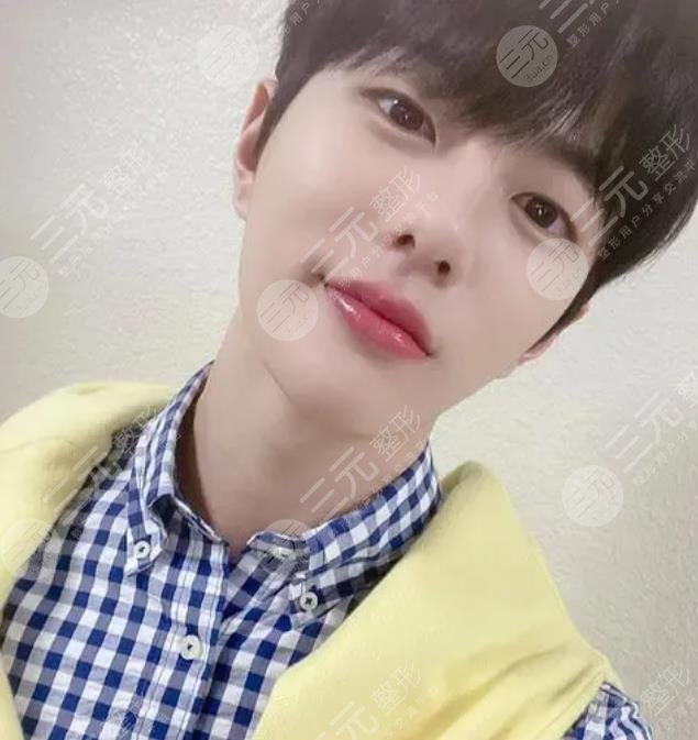 崔普閔整容盤點(diǎn)