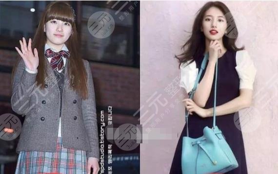 裴秀智微調(diào)整容參考標(biāo)準(zhǔn)！變美拿下李敏鎬，來(lái)看看她整了哪里！