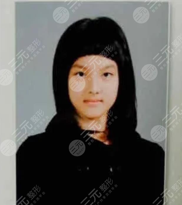 林娜璉整容了嗎?