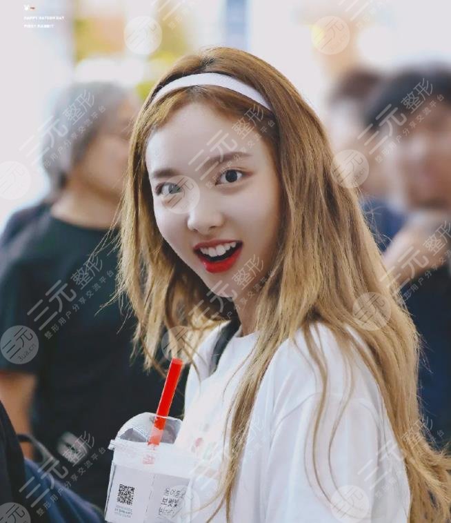 林娜璉顏值下降了?