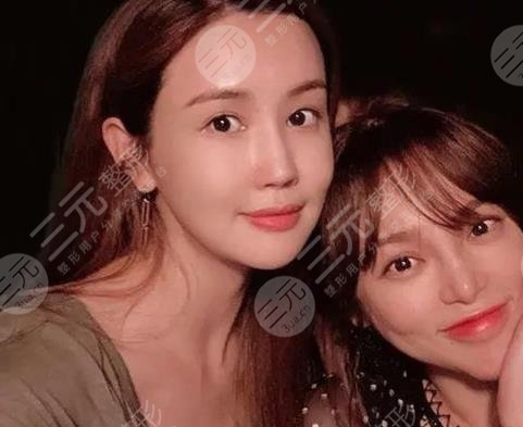 李多海整容多次變臉失??？成韓國整形反面教材！盤點(diǎn)她的整容歷程