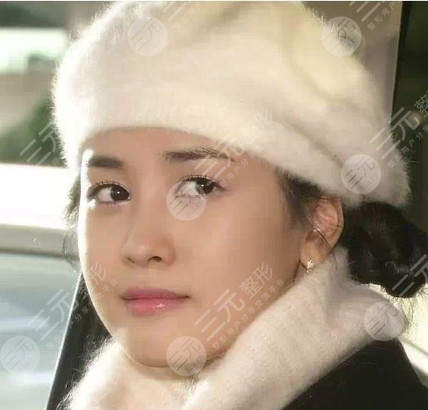 李多海整了那些地方?