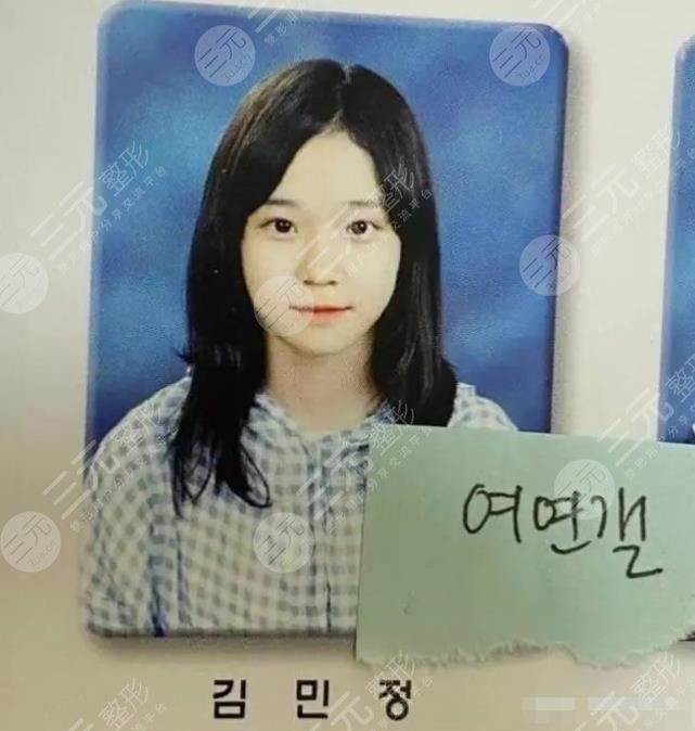 aespa金玟庭(winter)整容了嗎?