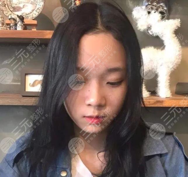 aespa金玟庭(winter)整容了嗎?