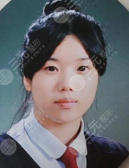 權(quán)恩妃整容了嗎?