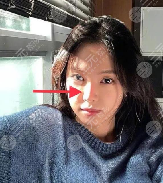 孫娜恩近照鼻子透光被網(wǎng)友熱議整容失??？Apink門(mén)面就此隕落！