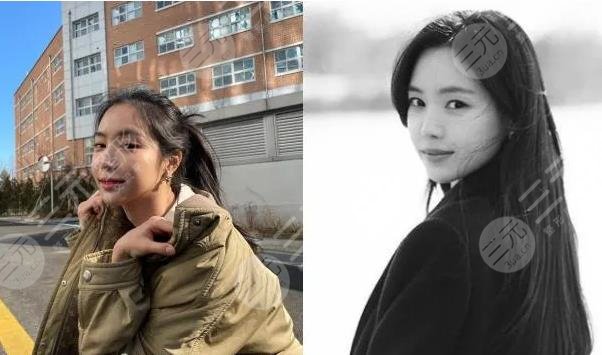 前Apink門(mén)面近照鼻子透光疑似整容失敗?