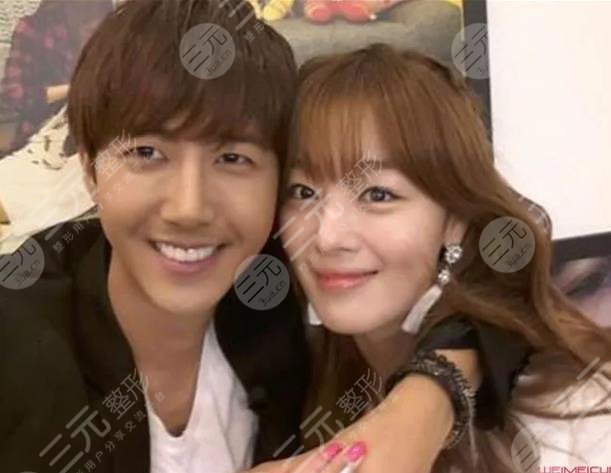 黃光熙整容歷史盤點!