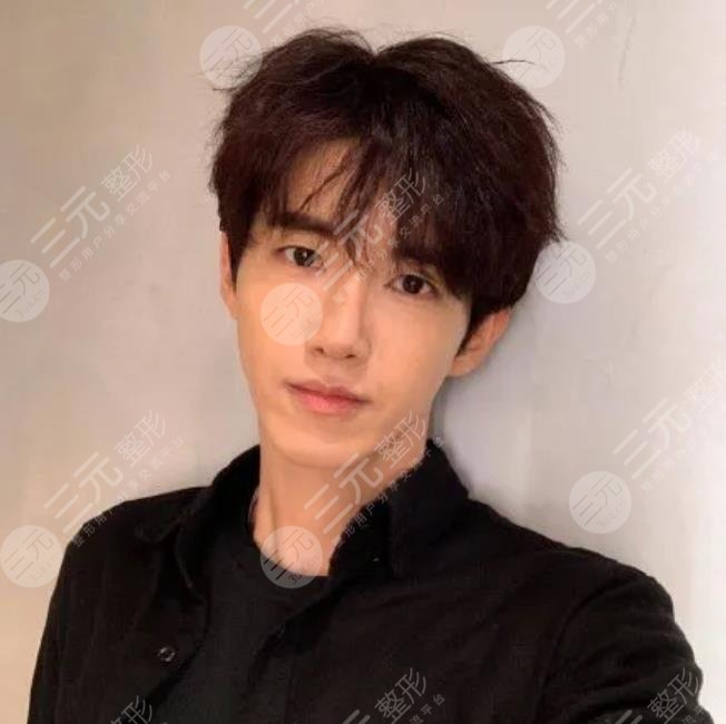 黃光熙整容失敗男愛豆近照曝光！他再次在大眾眼前“換頭”成功！