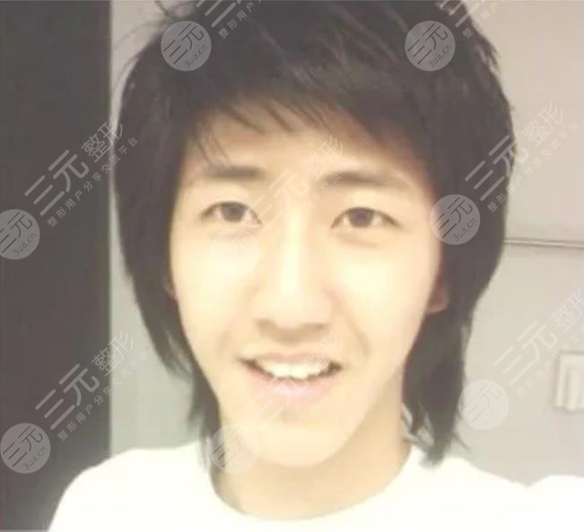 黃光熙整容歷史盤點!