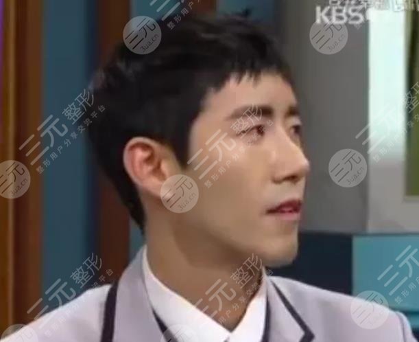 黃光熙近照“換頭”成功整容失敗修復(fù)實例!