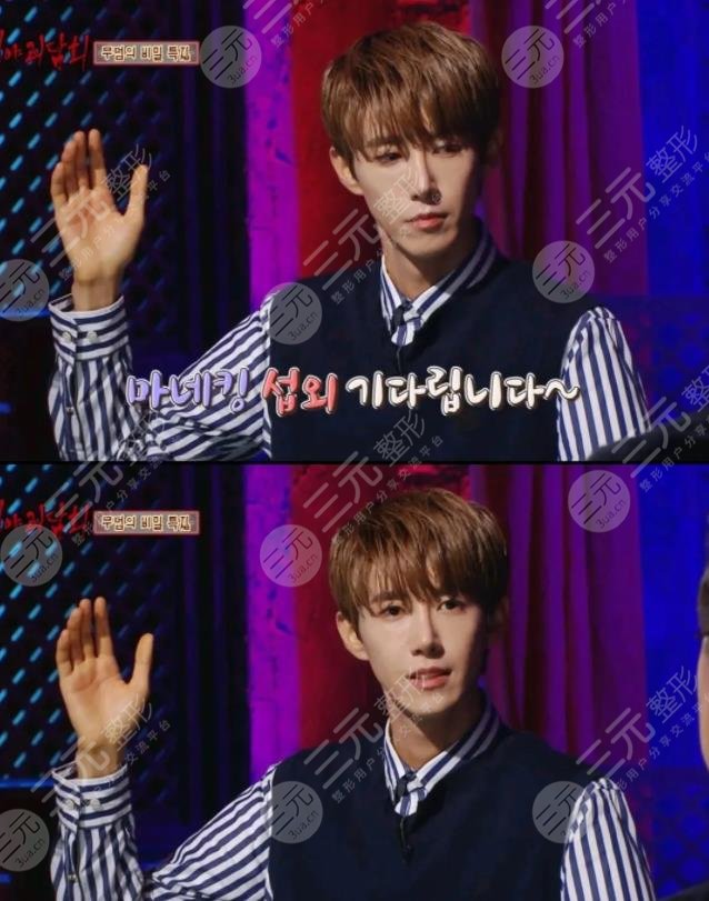 黃光熙近照“換頭”成功整容失敗修復(fù)實例!