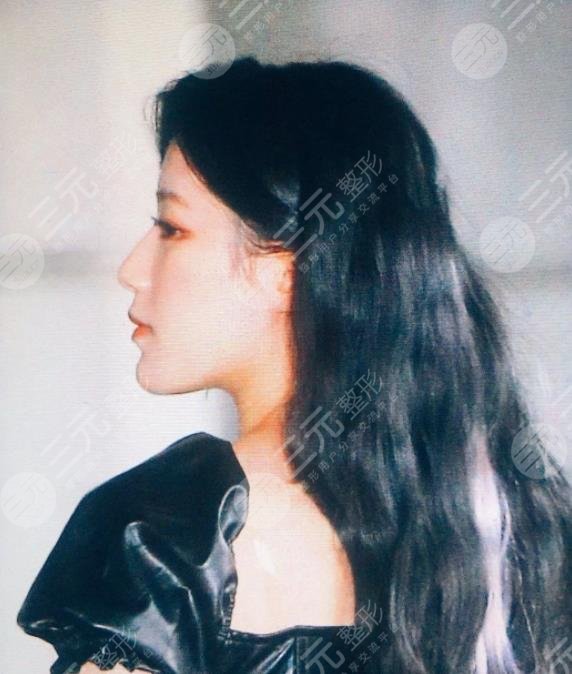 (G)I-DLE葉舒華門面出道卻備受顏值爭議！