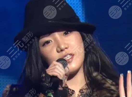 樸春變臉成“怪物”?她動(dòng)了哪些地方?