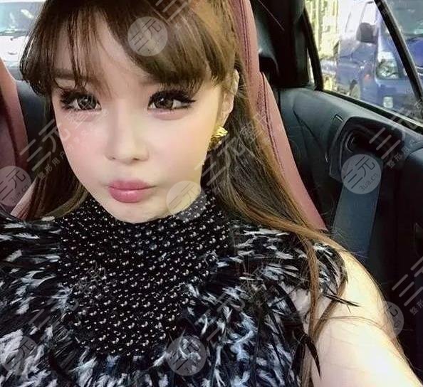 樸春變臉成“怪物”?她動(dòng)了哪些地方?