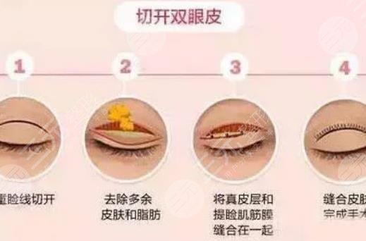 眼部手術手術可以和隆鼻一起做嗎?