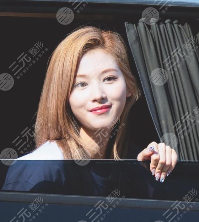 TWICE湊崎紗夏(sana)顏值如何?