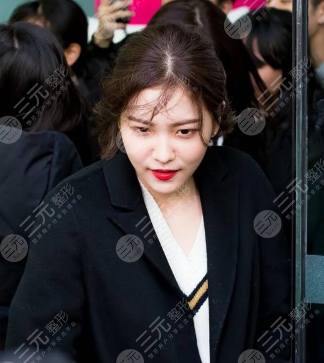 金藝琳顏值有缺陷嗎?