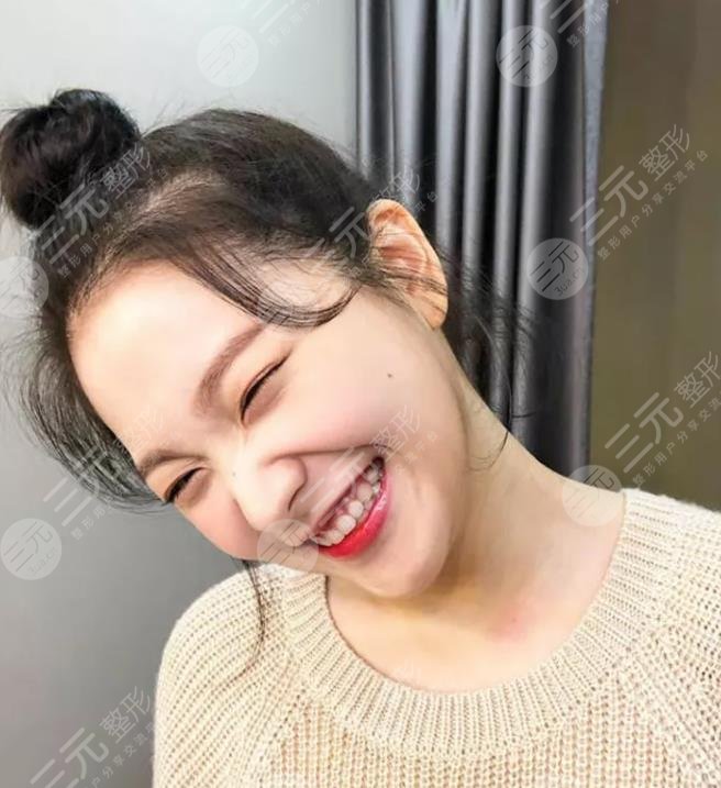 金藝琳顏值有缺陷嗎?