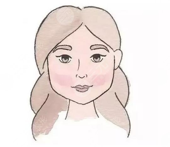 鼻尖肥大整形+自體脂肪填充蘋果肌 收獲一張網(wǎng)紅臉