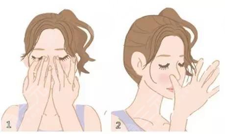 非手術(shù)隆鼻+鼻尖肥大整形 御姐范十足