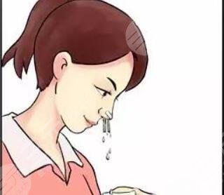 鼻尖肥大整形+鼻翼縮小前后對(duì)比 不再是“豬鼻子”