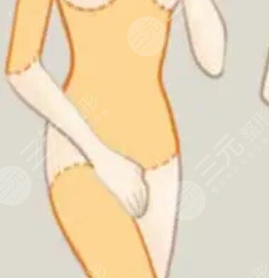 腰腹吸脂手術(shù)恢復(fù)果對(duì)比照片擺脫“游泳圈”