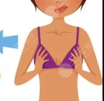 上海華美謝衛(wèi)國(guó)雙平面豐胸前后對(duì)比圖|平面模特的恢復(fù)日記