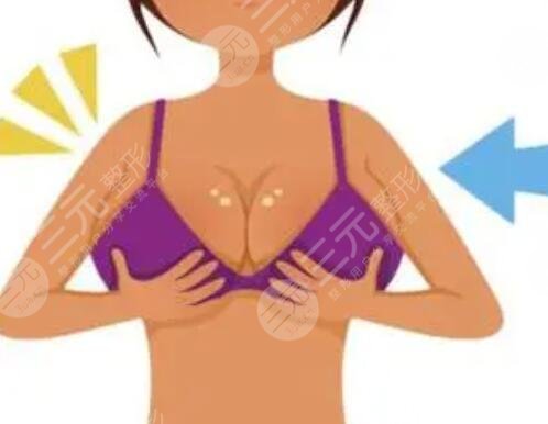 上海華美謝衛(wèi)國(guó)雙平面豐胸前后對(duì)比圖|平面模特的恢復(fù)日記