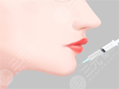 假體墊下巴12天恢復(fù)圖