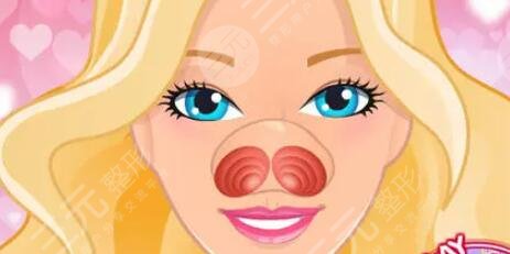 做完自體脂肪填充和隆鼻術(shù)后半個月