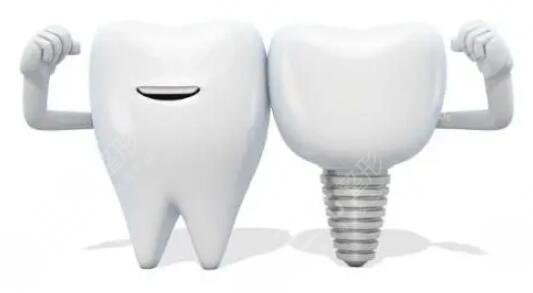 幾千塊的種植牙靠譜嗎？