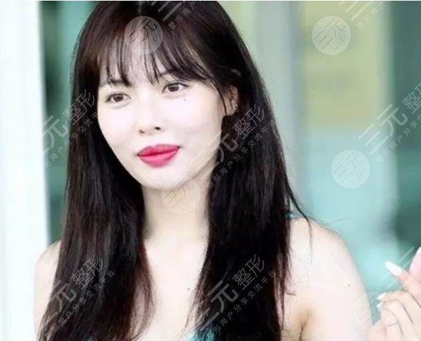 金泫雅否認(rèn)整容，但是豐唇確閉口不談?