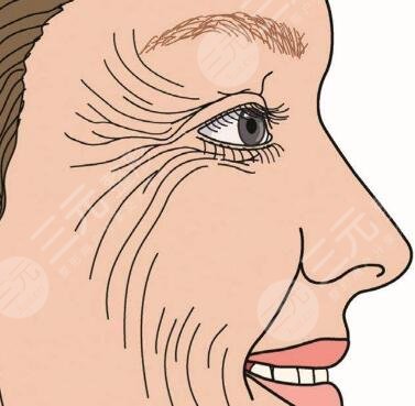 怎樣快速去除抬頭紋