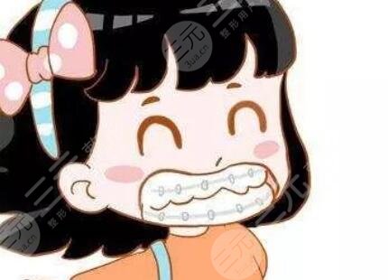 成都高新圣貝牙齒矯正貴不貴？附矯正案例過(guò)程分享