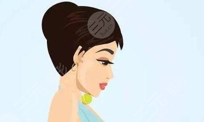 成都派瑞思整形**嗎？自體肋軟骨隆鼻案例分享