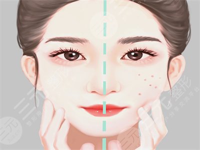 成都儷顏整形好不好？注射水光補(bǔ)水術(shù)后變美日記