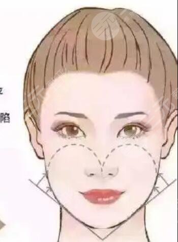 北京偉力嘉美信整形果如何？埋埋提升前后驚人對比