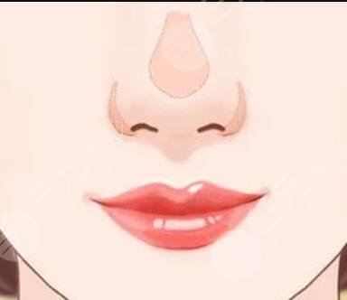 四川友誼醫(yī)院整形好不好？肋軟骨隆鼻變美分享