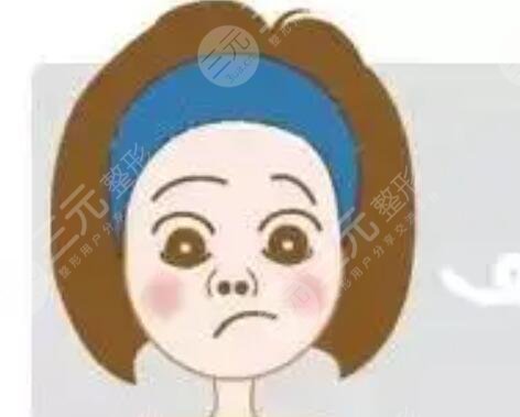 溫州藝星隆鼻整形貴不貴？隆鼻整形術(shù)后變美過程分享