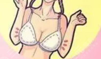 石良兵醫(yī)生隆胸怎么樣