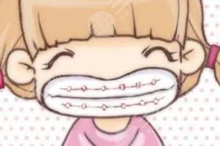 地包天矯正前后對(duì)比照片