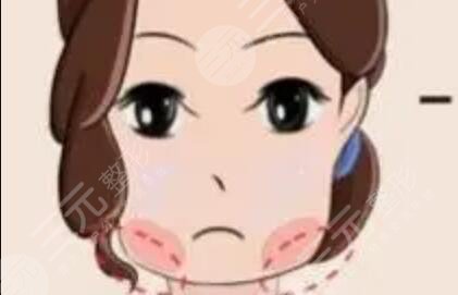 打注射瘦臉前后對比照片真實(shí)果圖