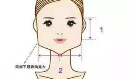 上海韓鏡金一秀醫(yī)生面診