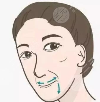 隆鼻整形真人案例 隆鼻整形恢復(fù)過程分享