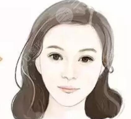 墊下巴案例 假體墊下巴恢復(fù)過程分享