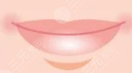 豐唇手術(shù)前后對比照片